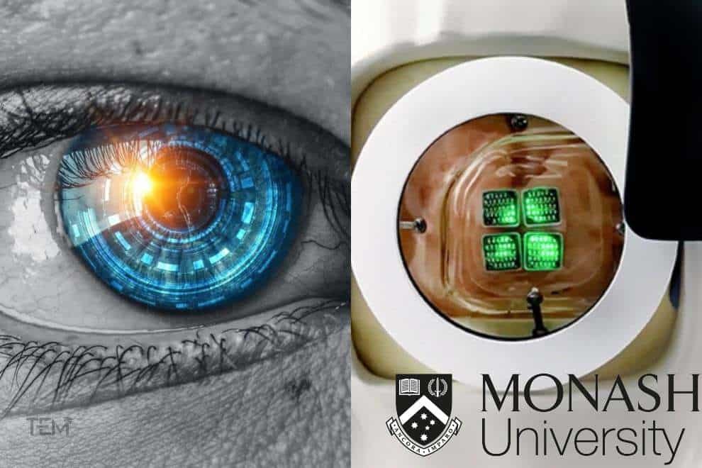 Bionic Eye